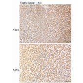 Solarbio K110608P Anti-CKAP5 Polyclonal Antibody