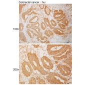 Solarbio K111106P Anti-CDH8 Polyclonal Antibody