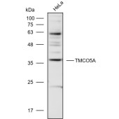 Solarbio K110982P Anti-TMCO5A Polyclonal Antibody
