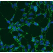 Solarbio K009912P Anti-NDFIP1 Polyclonal Antibody