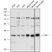 Solarbio K111719P Anti-TWF1 Polyclonal Antibody