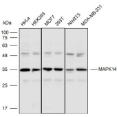 Solarbio K110539P Anti-MAPK14 Polyclonal Antibody