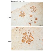 Solarbio K111067P Anti-TCF4 Polyclonal Antibody