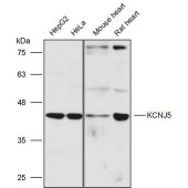 Solarbio K111466P Anti-KCNJ5 Polyclonal Antibody