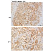 Solarbio K111623P Anti-TNFSF15 Polyclonal Antibody