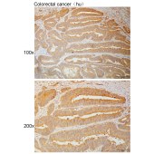Solarbio K110937P Anti-RPN2 Polyclonal Antibody