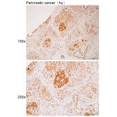 Solarbio K112122P Anti-IFIH1 Polyclonal Antibody