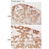Solarbio K111296P Anti-KAT2B Polyclonal Antibody