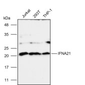 Solarbio K112125P Anti-IFNA21 Polyclonal Antibody