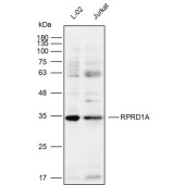Solarbio K111944P Anti-RPRD1A Polyclonal Antibody