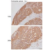 Solarbio K111498P Anti-ENPP2 Polyclonal Antibody