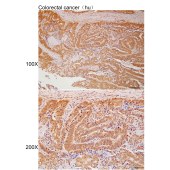 Solarbio K111982P Anti-RBM4B Polyclonal Antibody
