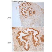 Solarbio K111794P Anti-HGD Polyclonal Antibody