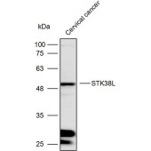 Solarbio K111739P Anti-STK38L Polyclonal Antibody