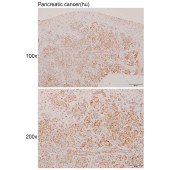 Solarbio K110940P Anti-AMBRA1 Polyclonal Antibody
