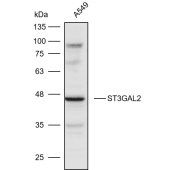 Solarbio K110589P Anti-ST3GAL2 Polyclonal Antibody
