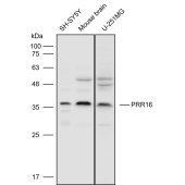 Solarbio K110717P Anti-PRR16 Polyclonal Antibody