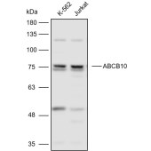 Solarbio K111071P Anti-ABCB10 Polyclonal Antibody