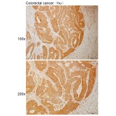 Solarbio K110950P Anti-VILL Polyclonal Antibody