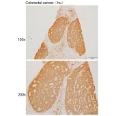 Solarbio K111418P Anti-HCFC1 Polyclonal Antibody