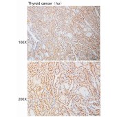 Solarbio K110938P Anti-SS18L1 Polyclonal Antibody