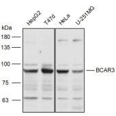 Solarbio K111291P Anti-BCAR3 Polyclonal Antibody