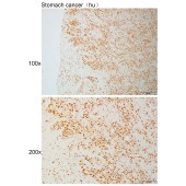 Solarbio K111046P Anti-PINX1 Polyclonal Antibody