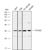 Solarbio K112107P Anti-TICAM2 Polyclonal Antibody