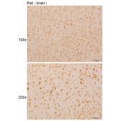 Solarbio K110910P Anti-CA8 Polyclonal Antibody