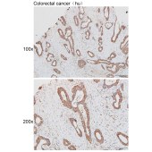 Solarbio K111936P Anti-NSUN7 Polyclonal Antibody