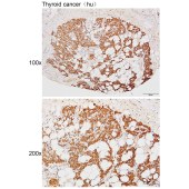 Solarbio K111467P Anti-KLK4 Polyclonal Antibody