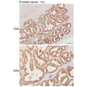 Solarbio K111467P Anti-KLK4 Polyclonal Antibody