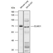 Solarbio K111961P Anti-ELMO1 Polyclonal Antibody