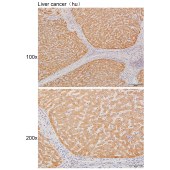 Solarbio K111239P Anti-CYP2C9 Polyclonal Antibody