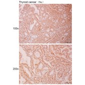 Solarbio K111008P Anti-SPART Polyclonal Antibody