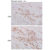 Solarbio K111472P Anti-E2F8 Polyclonal Antibody