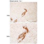 Solarbio K111864P Anti-CCNE1 Polyclonal Antibody