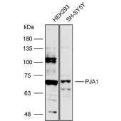 Solarbio K111759P Anti-PJA1 Polyclonal Antibody