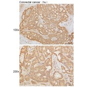 Solarbio K111622P Anti-EIF4EBP1 Polyclonal Antibody