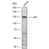 Solarbio K111061P Anti-JMY Polyclonal Antibody