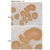 Solarbio K111930P Anti-CDKN2C Polyclonal Antibody