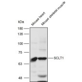 Solarbio K110985P Anti-SCLT1 Polyclonal Antibody