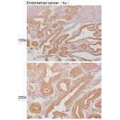 Solarbio K111292P Anti-MALT1 Polyclonal Antibody