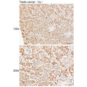 Solarbio K111440P Anti-GC Polyclonal Antibody