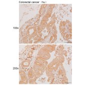 Solarbio K111052P Anti-KCNA1 Polyclonal Antibody