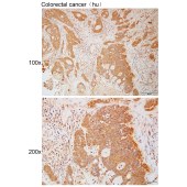 Solarbio K111803P Anti-PAEP Polyclonal Antibody