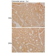 Solarbio K111465P Anti-TMED6 Polyclonal Antibody
