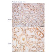 Solarbio K110604P Anti-CHEK2 Polyclonal Antibody