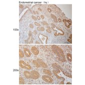 Solarbio K111088P Anti-IKBKB Polyclonal Antibody
