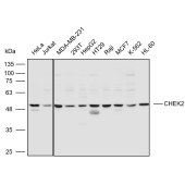 Solarbio K110604P Anti-CHEK2 Polyclonal Antibody
